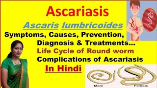 Ascariasis  Ascaris Lumbricoides  Symptoms Causes Diagnosis Treatment  Roundworm life cycle [upl. by Konyn]