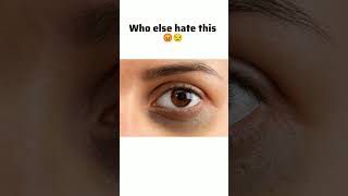 Who else hate this 😡😒funny relatable childhoodnostalgia short trending viralshort [upl. by Adnocahs]