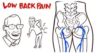 Low Back Pain [upl. by Nerty]