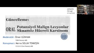 ODMFR Oral Potansiyel Malign Lezyonlar Oral Skuamöz Hücreli Karsinom [upl. by Primo390]