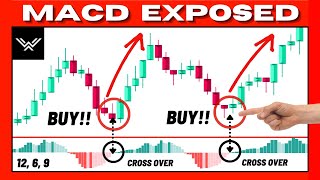 Ultimate MACD Indicator Trading Course EXPERT INSTANTLY [upl. by Eno517]