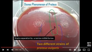 Dienes Phenomenon of Proteus Positive Demonstration [upl. by Nogem112]