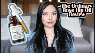 The Ordinary 100 Organic ColdPressed Rose Hip Seed Oil Review [upl. by Ravid307]