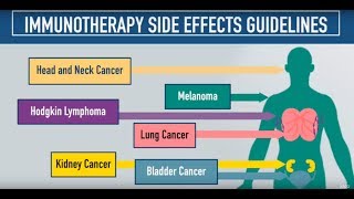 Immunotherapy Side Effects Guidelines [upl. by Atinid]