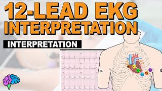 The SIMPLE Steps of 12Lead EKG Interpretation  EXPLAINED CLEARLY [upl. by Perpetua]