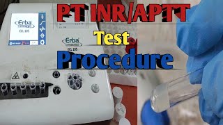 PT INR Test Procedure  Prothrombin Time  PT APTT Blood Test Procedure [upl. by Martina]