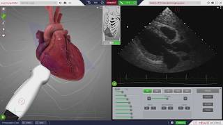 Standard Imaging Planes  HeartWorks Issue 10 [upl. by Neelrac]