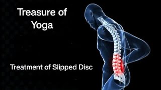 Slip Disc Exercises  Treatment of L4  L5 problems [upl. by Thia]