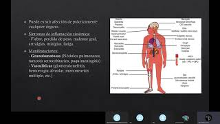 Granulomatosis con Poliangeitis [upl. by Velleman]