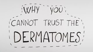 Why you cannot trust the dermatomes [upl. by Piselli]