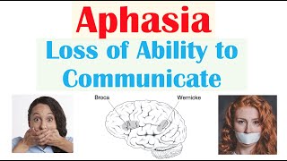 Aphasia  Types Broca’s Wernicke’s Global Causes Signs amp Symptoms Diagnosis Treatment [upl. by Ahsele]