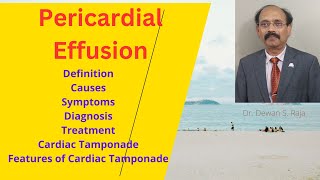 Pericardial Effusion [upl. by Assirahc]