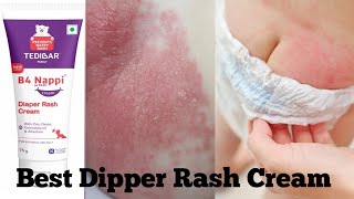 Best Dipper Rash Cream For Baby babyvideos babycare babyproducts babies [upl. by Jule478]