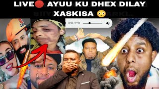 DEGDEG • DAGAAL CULUS • DAAHIR O LIVE🔴 KU DHEX DILAY XASKISA SUBXANALAH SOO DAAWO CEEBTANI😳 [upl. by Haraj]