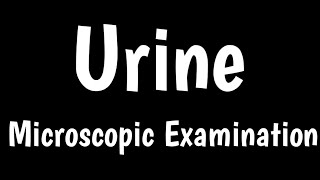 Microscopic Examination Of Urine  Urinalysis  Pus Cells Epithelial Cells amp Leukocytes In Urine [upl. by Bravin]