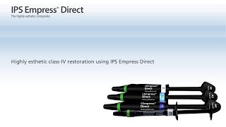 IPS Empress Direct – The material for highly esthetic fillings [upl. by Sergias]