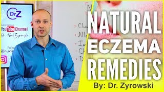 Natural Eczema Remedies  Actually Works [upl. by Louis]