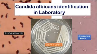 Candida growth on SDA Gram stain and Germ tube test Positive [upl. by Alocin355]