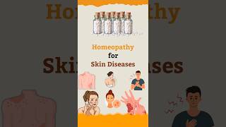 Homeopathy for Skin Diseases  Life Force Homeopathy homeopathyheals [upl. by Adorl754]