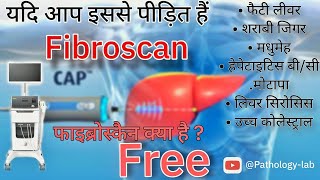 FIBROSCAN OF LIVER  फाइब्रोस्कैन kaise hota hai dheko फाइब्रोस्कैन क्या है  tranding shortvideo [upl. by Frants]