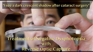 These 4 New Lenses Will Change Cataract Surgery FOREVER  Ophthalmologist MichaelRChuaMD [upl. by Epuladaugairam]