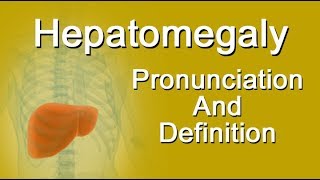 Hepatomegaly Pronunciation And Definition [upl. by Bendite]