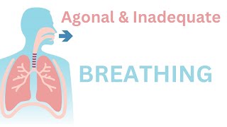 Agonal Breathing Demonstrated [upl. by Bushey]