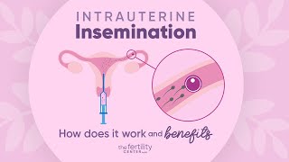 Intrauterine Insemination How Does It Work amp Benefits  The Fertility Center [upl. by Netsruk]