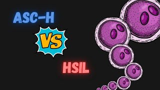 Diferencias entre ASCH y HSIL Citología cervicovaginal [upl. by Suehtomit]