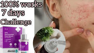 The Derma co Niacinamide serum review in kannada How To Use niacinamide serum for Acne scars marks [upl. by Levine226]