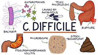 Understanding Clostridium Difficile Infection C Diff [upl. by Nnylirak]