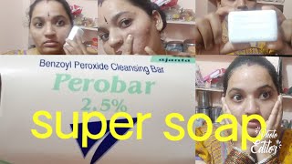 How to remove Pimples in one day perobar super solution in telugu [upl. by Tirrag]