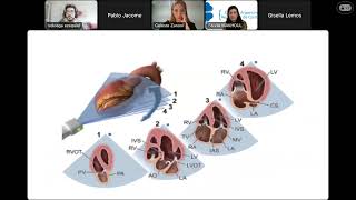 Introducción a la Ecocardiografia en UCO de CONAREC  Parte 1 [upl. by Doralia]