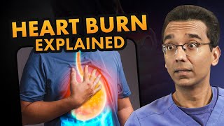 Say Goodbye to Heartburn The Complete Guide to FIX Heartburn GERD amp Acid Reflux [upl. by Chicoine]