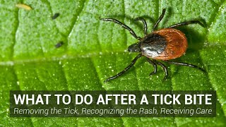 What to Do After a Tick Bite  Johns Hopkins Lyme Disease Research Center [upl. by Ardnasil]