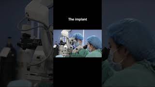 Specific Developments in Glaucoma Treatment Options and Understanding  iDose® TR Implant [upl. by Leamhsi]