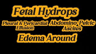 Fetal Hydrops  Ascites  Swelling  Pleural amp Pericardial Effusion  IUD 25 weeks on Ultrasound [upl. by Andi552]