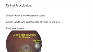 Retinal artery amp vein occlusion [upl. by Gunn]