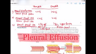 Pleural Effusion  Transudate Vs Exudate Respiratory 47  First Aid USMLE Step 1 in UrduHindi [upl. by Langham]