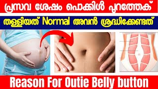 Reason For Outie Belly Button Bulged Belly Button  After Delivery Care [upl. by Obrien]