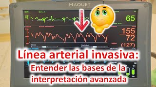 Línea arterial entender las bases para la interpretación avanzada [upl. by Anohsal]