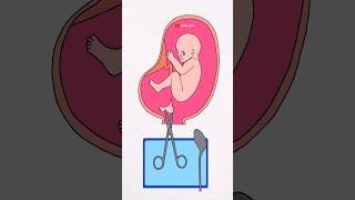 Dont be cruel to your baby 🥺😭 artbylaba shorts shortsfeed deepmeaning animationvideo [upl. by Gweneth]