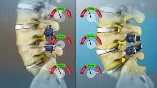 TOPS System animation comparison to fusion [upl. by Maxey]