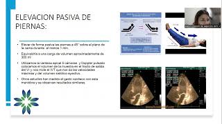 Gasto cardiaco Revision bibliografica  Unidad de Ultrasonografia de Emergencias [upl. by Hourigan]