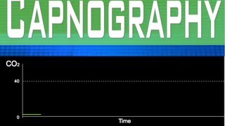 EtCO2 Capnography Part 2 [upl. by Ohcamac]