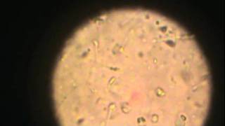 Observación de espermatozoides en microscopio óptico 1 [upl. by Supmart]