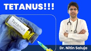 💉 Tetanus Injection time limit after injury I 💉 Tetanus  Symptoms amp Treatment [upl. by Marylynne221]