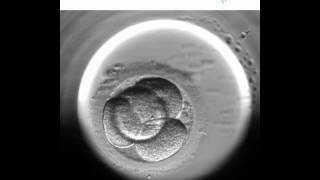 Embryoscope 1  Nuevo método de cultivo y selección embrionaria [upl. by Quinlan]