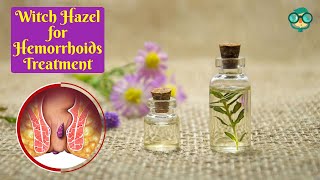 How to Use Witch Hazel for Hemorrhoids Treatment Witch Hazel Benefits for Hemorrhoids How to Use [upl. by Myrtice]