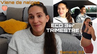 ECO 3er trimestre EMBARAZO🤰🏻 Viene de nalgas 🍑  Preparación al parto  Semana 33 [upl. by Giefer479]